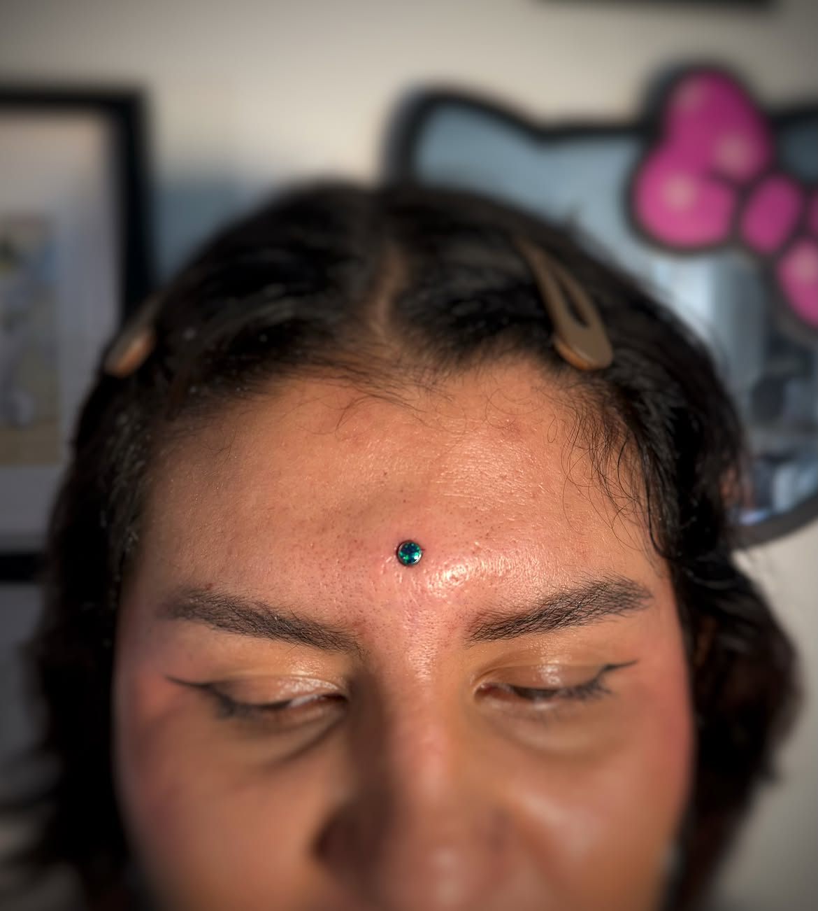 Microdermal Titanio